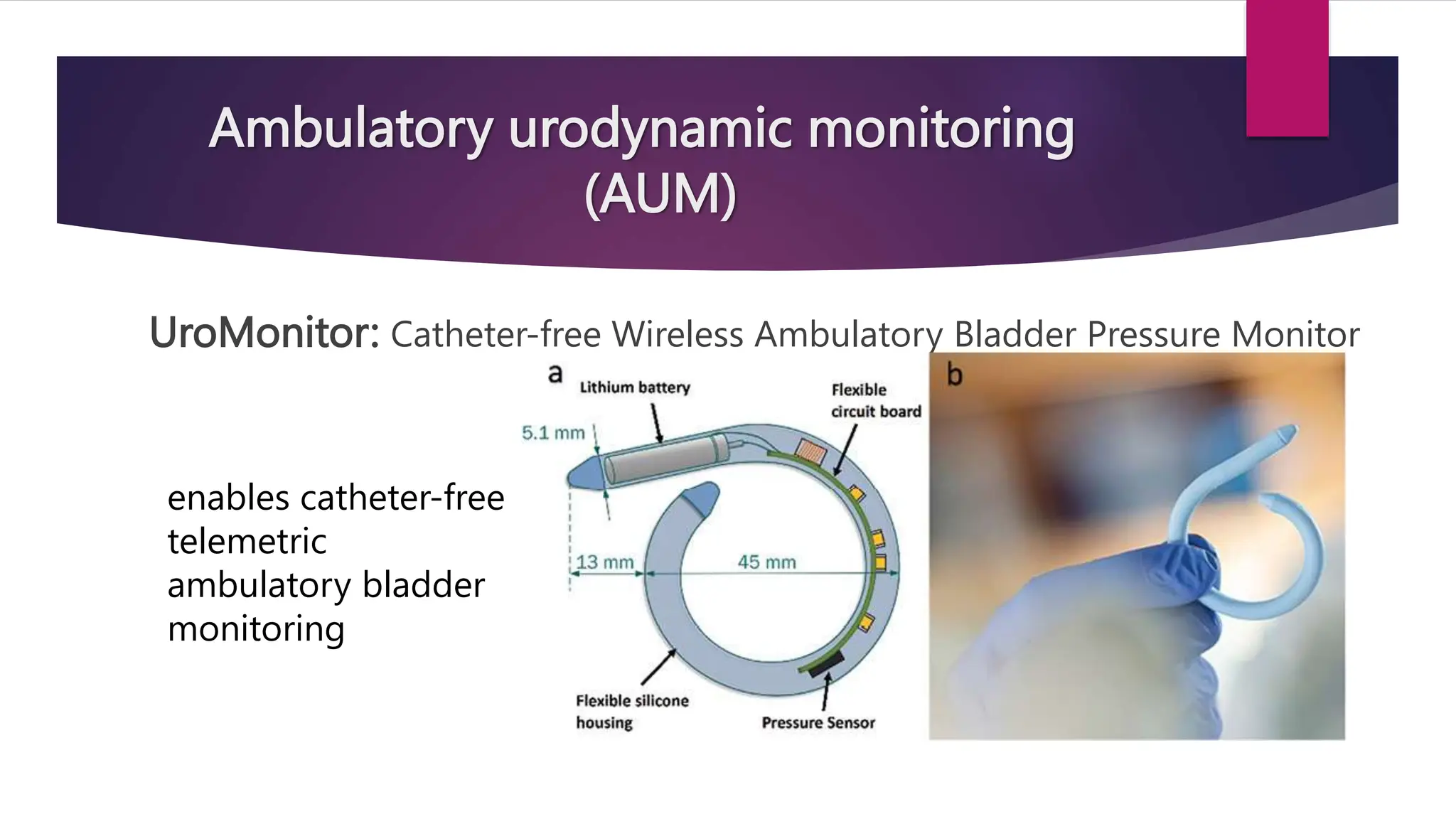 Ambulatory urodynamic monitoring
(AUM)
UroMonitor: Catheter-free Wireless Ambulatory Bladder Pressure Monitor
enables catheter-free
telemetric
ambulatory bladder
monitoring
 