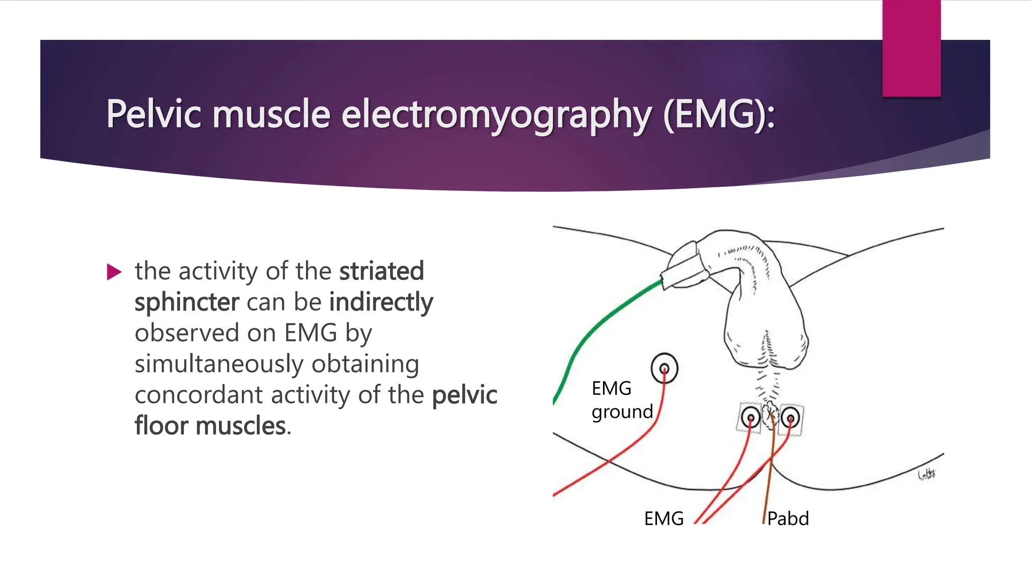 Pelvic muscle electromyography (EMG):
 the activity of the striated
sphincter can be indirectly
observed on EMG by
simultaneously obtaining
concordant activity of the pelvic
floor muscles.
Pabd
EMG
EMG
ground
 
