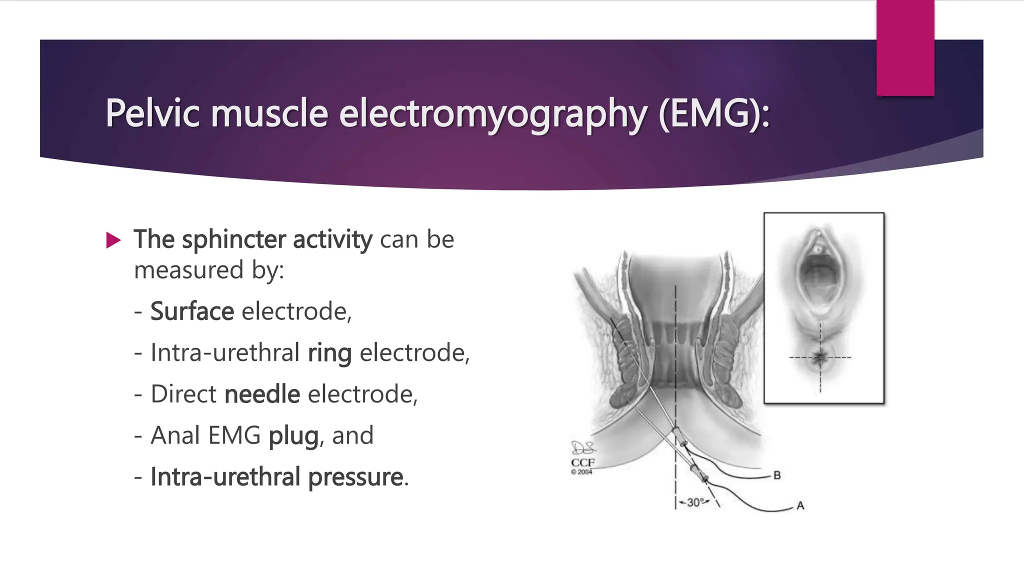Pelvic muscle electromyography (EMG):
 The sphincter activity can be
measured by:
- Surface electrode,
- Intra-urethral ring electrode,
- Direct needle electrode,
- Anal EMG plug, and
- Intra-urethral pressure.
 