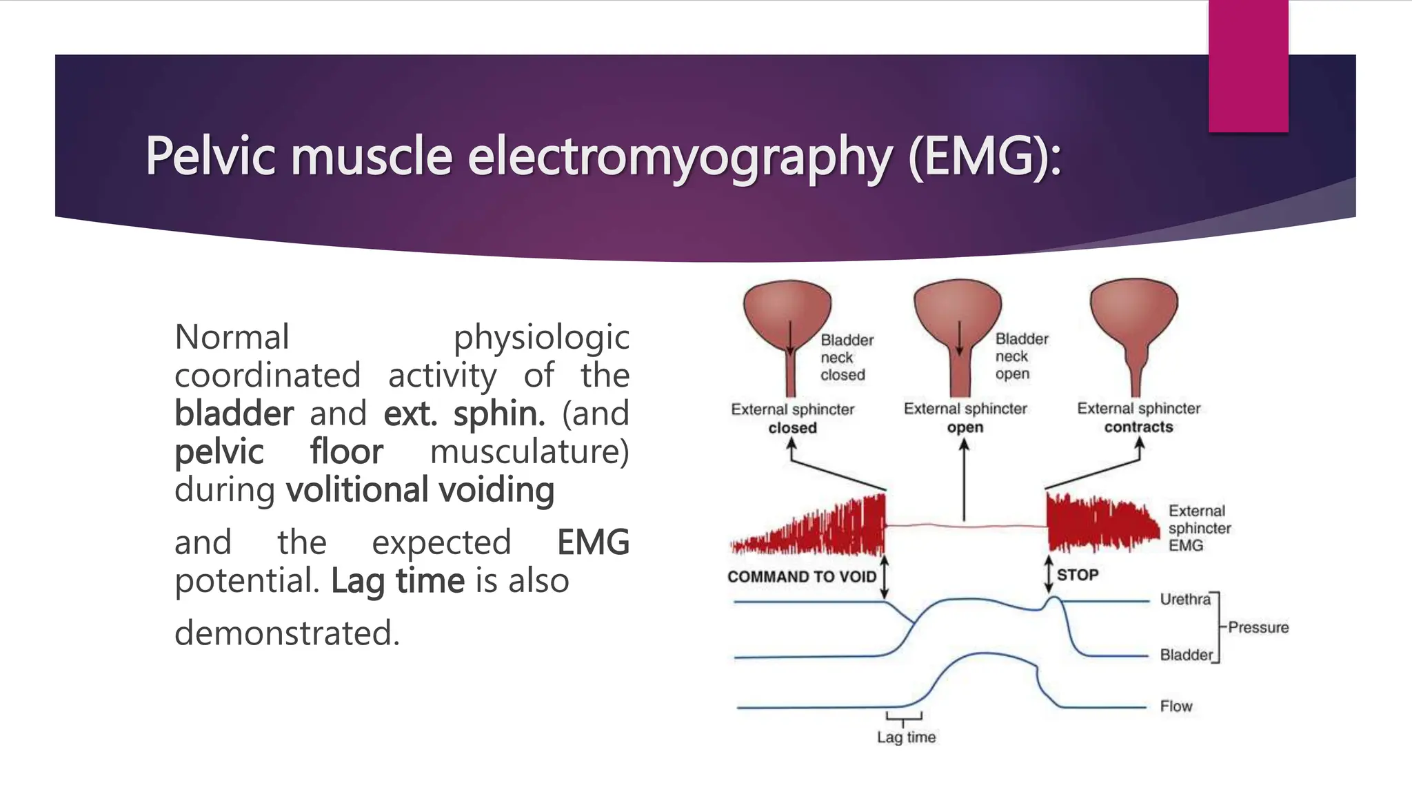 Pelvic muscle electromyography (EMG):
Normal physiologic
coordinated activity of the
bladder and ext. sphin. (and
pelvic floor musculature)
during volitional voiding
and the expected EMG
potential. Lag time is also
demonstrated.
 