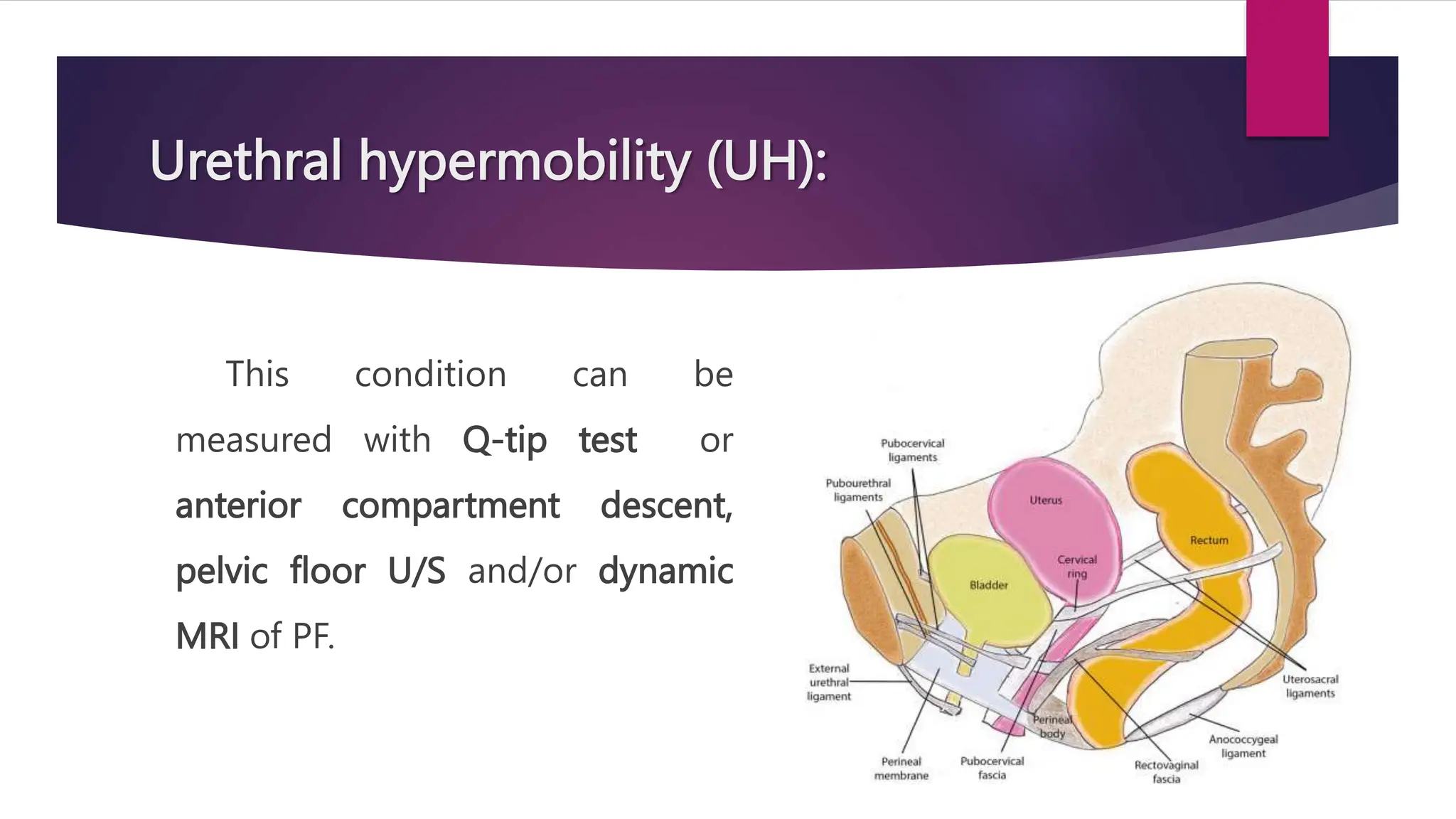 Urethral hypermobility (UH):
This condition can be
measured with Q-tip test or
anterior compartment descent,
pelvic floor U/S and/or dynamic
MRI of PF.
 