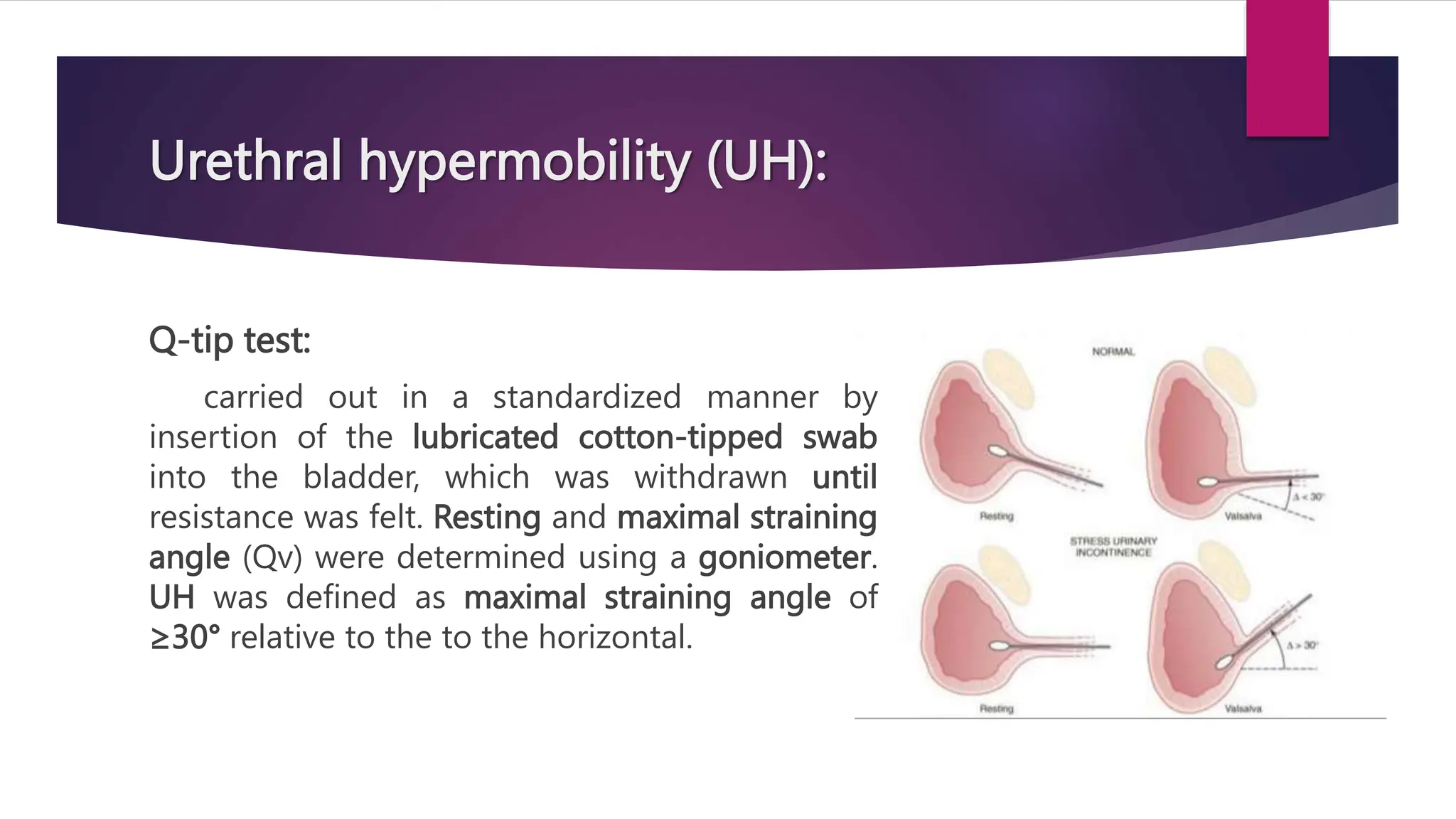 Urethral hypermobility (UH):
Q-tip test:
carried out in a standardized manner by
insertion of the lubricated cotton-tipped swab
into the bladder, which was withdrawn until
resistance was felt. Resting and maximal straining
angle (Qv) were determined using a goniometer.
UH was defined as maximal straining angle of
≥30° relative to the to the horizontal.
 
