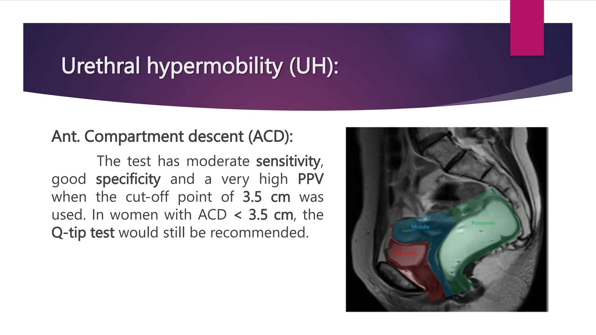 Urethral hypermobility (UH):
Ant. Compartment descent (ACD):
The test has moderate sensitivity,
good specificity and a very high PPV
when the cut-off point of 3.5 cm was
used. In women with ACD < 3.5 cm, the
Q-tip test would still be recommended.
 