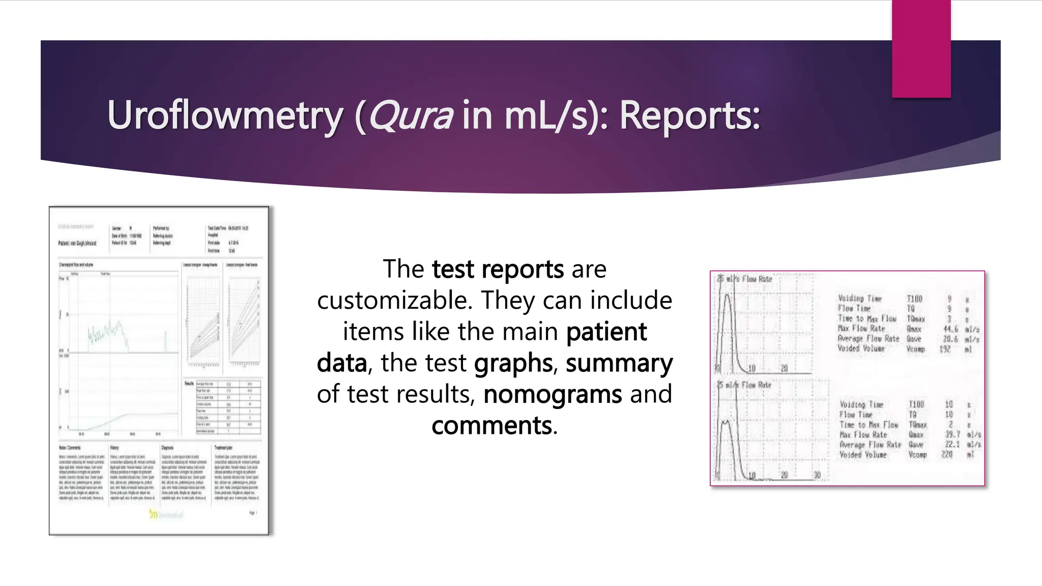Uroflowmetry (Qura in mL/s): Reports:
The test reports are
customizable. They can include
items like the main patient
data, the test graphs, summary
of test results, nomograms and
comments.
 