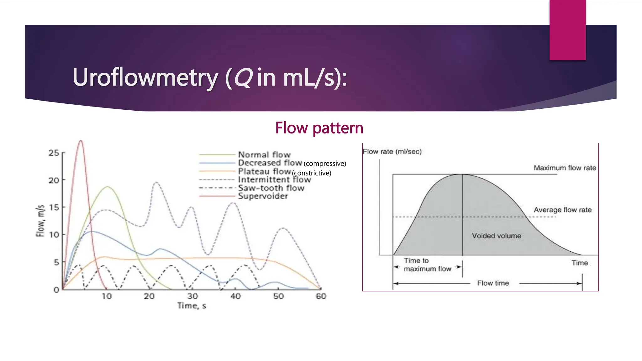 Uroflowmetry (Q in mL/s):
Flow pattern
(compressive)
(constrictive)
 