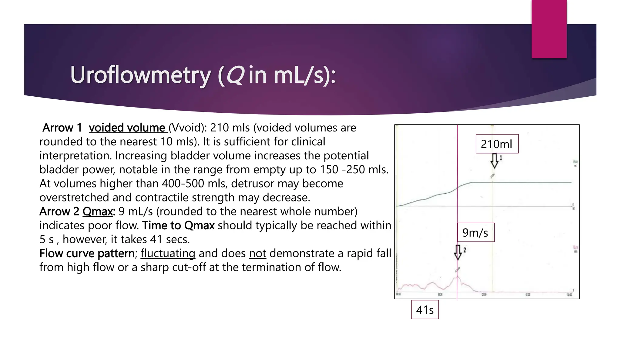 Uroflowmetry (Q in mL/s):
Arrow 1 voided volume (Vvoid): 210 mls (voided volumes are
rounded to the nearest 10 mls). It is sufficient for clinical
interpretation. Increasing bladder volume increases the potential
bladder power, notable in the range from empty up to 150 -250 mls.
At volumes higher than 400-500 mls, detrusor may become
overstretched and contractile strength may decrease.
Arrow 2 Qmax: 9 mL/s (rounded to the nearest whole number)
indicates poor flow. Time to Qmax should typically be reached within
5 s , however, it takes 41 secs.
Flow curve pattern; fluctuating and does not demonstrate a rapid fall
from high flow or a sharp cut-off at the termination of flow.
210ml
41s
9m/s
 