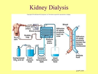 26-36
Kidney Dialysis
 
