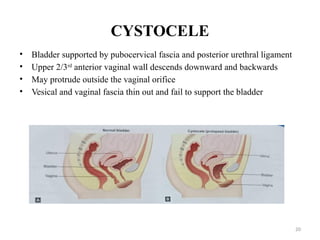 Urogenital Dysfunction and prolapse.pptx