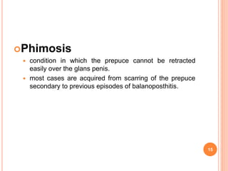Phimosis
 condition in which the prepuce cannot be retracted
easily over the glans penis.
 most cases are acquired from scarring of the prepuce
secondary to previous episodes of balanoposthitis.
15
 