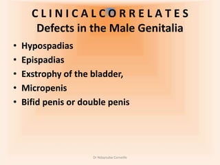 Urogenital System Embryology.pptx
