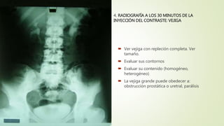 4. RADIOGRAFÍA A LOS 30 MINUTOS DE LA
INYECCIÓN DEL CONTRASTE: VEJIGA
 Ver vejiga con repleción completa. Ver
tamaño.
 Evaluar sus contornos
 Evaluar su contenido (homogéneo,
heterogéneo)
 La vejiga grande puede obedecer a:
obstrucción prostática o uretral, parálisis
 