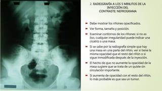 2. RADIOGRAFÍA A LOS 5 MINUTOS DE LA
INYECCIÓN DEL
CONTRASTE: NEFROGRAMA
 Debe mostrar los riñones opacificados.
 Ver forma, tamaño y posición.
 Examinar contornos de los riñones: si no es
liso, cualquier irregularidad puede indicar una
cicatriz o una masa.
 Si se sabe por la radiografía simple que hay
una masa en una parte del riñón, ver si tiene la
misma opacidad que el resto del riñón o si
sigue inmodificada después de la inyección.
 El hecho de que no aumente la opacidad de la
masa sugiere que se trata de un quiste sin
circulación importante.
 Si aumenta de opacidad con el resto del riñón,
lo más probable es que sea un tumor.
 
