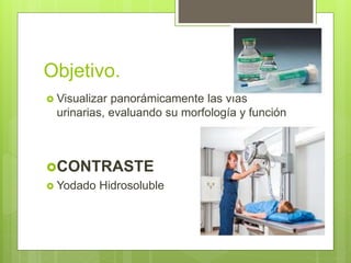 Objetivo.
 Visualizar panorámicamente las vías
urinarias, evaluando su morfología y función
CONTRASTE
 Yodado Hidrosoluble
 