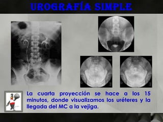 Urografía simple




La cuarta proyección se hace a los 15
minutos, donde visualizamos los uréteres y la
llegada del MC a la vejiga.
 