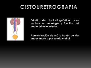 Estudio de Radiodiagnóstico para
evaluar la morfología y función del
tracto Urinario Inferior.


Administración de MC a través de vía
endovenosa o por sonda uretral
 