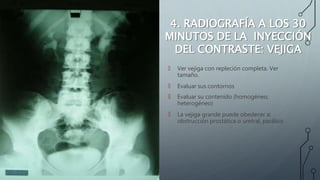 4. RADIOGRAFÍA A LOS 30
MINUTOS DE LA INYECCIÓN
DEL CONTRASTE: VEJIGA
🠶 Ver vejiga con repleción completa. Ver
tamaño.
🠶 Evaluar sus contornos
🠶 Evaluar su contenido (homogéneo,
heterogéneo)
🠶 La vejiga grande puede obedecer a:
obstrucción prostática o uretral, parálisis
 