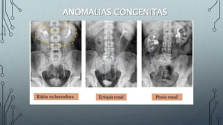 ANOMALIAS CONGENITAS
 