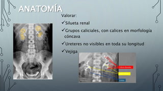 ANATOMÍA
Valorar:
Silueta renal
Grupos caliciales, con calices en morfología
cóncava
Ureteres no visibles en toda su longitud
Vejiga
 