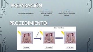 PREPARACIÓN
Dieta blanda 8 a 12 horas.
Limpiar intestinos por
medio de enema o
laxantes.
En caso de observar
materia fecal se pospone el
estudio.
PROCEDIMIENTO
 
