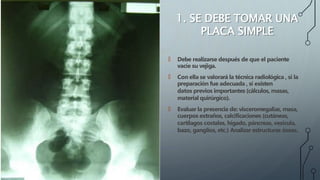 1. SE DEBE TOMAR UNA
PLACA SIMPLE
🠶 Debe realizarse después de que el paciente
vacíe su vejiga.
🠶 Con ella se valorará la técnica radiológica , sí la
preparación fue adecuada , sí existen
datos previos importantes (càlculos, masas,
material quirúrgico).
🠶 Evaluar la presencia de: visceromegalias, masa,
cuerpos extraños, calcificaciones (cutáneas,
cartílagos costales, hígado, páncreas, vesícula,
bazo, ganglios, etc.) Analizar estructuras óseas.
 