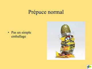 Prépuce normal ,[object Object]
