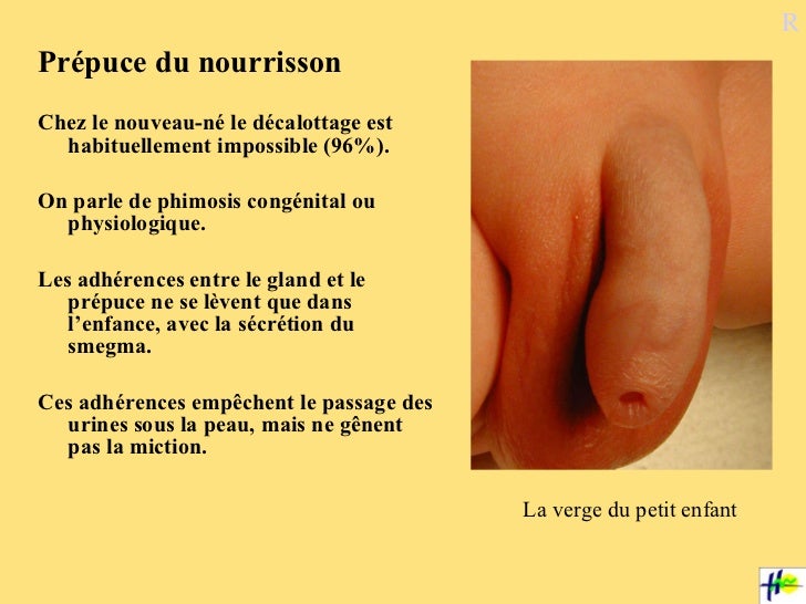 Urogyn Pedia 2 Rm 12 04 11