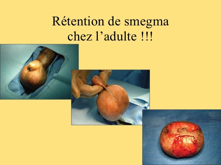 Urogyn pedia 2 rm 12 04 11