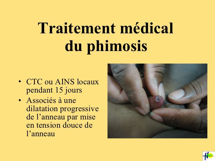 Urogyn pedia 2 rm 12 04 11