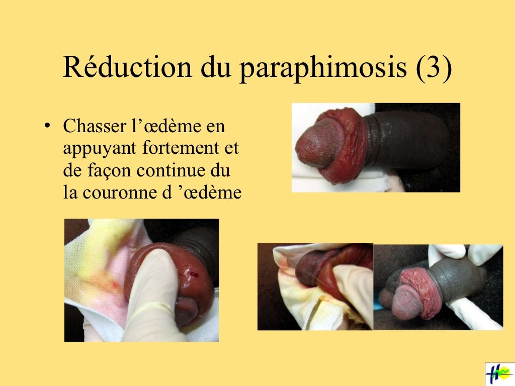 Urogyn pedia 2 rm 12 04 11