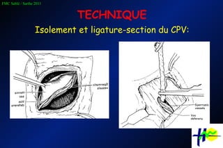 TECHNIQUE Isolement et ligature-section du CPV: 