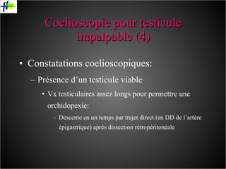 Coelioscopie pour testicule impalpable (4) Constatations coelioscopiques: Présence d’un testicule viable Vx testiculaires assez longs pour permettre une orchidopexie: Descente en un temps par trajet direct (en DD de l’artère épigastrique) après dissection rétropéritonéale 