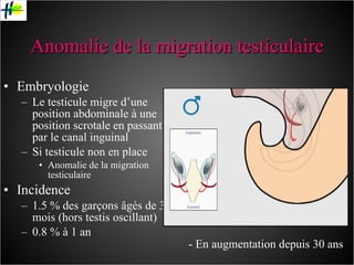 Anomalie de la migration testiculaire Embryologie  Le testicule migre d’une position abdominale à une position scrotale en passant par le canal inguinal Si testicule non en place Anomalie de la migration testiculaire Incidence 1.5 % des garçons âgés de 3 mois (hors testis oscillant) 0.8 % à 1 an - En augmentation depuis 30 ans 