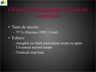 Chirurgie coelioscopique du testicule impalpable Taux de succès: 77 % (Docimo 1995 J Urol) Echecs: Atrophie ou fonte testiculaire avant ou après l’éventuel second temps Testicule trop haut 