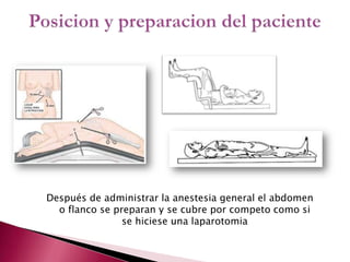Después de administrar la anestesia general el abdomen o flanco se preparan y se cubre por competo como si se hiciese una laparotomiaPosicion y preparacion del paciente  