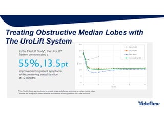 urolift ppt , Minimally invasive treatment for prostate enlargement.pptx
