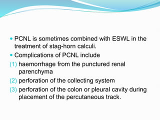 urolithasis.pptx for medical purposes... | PPTX