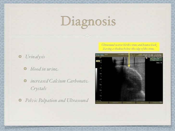 Urolithiasis symptoms image