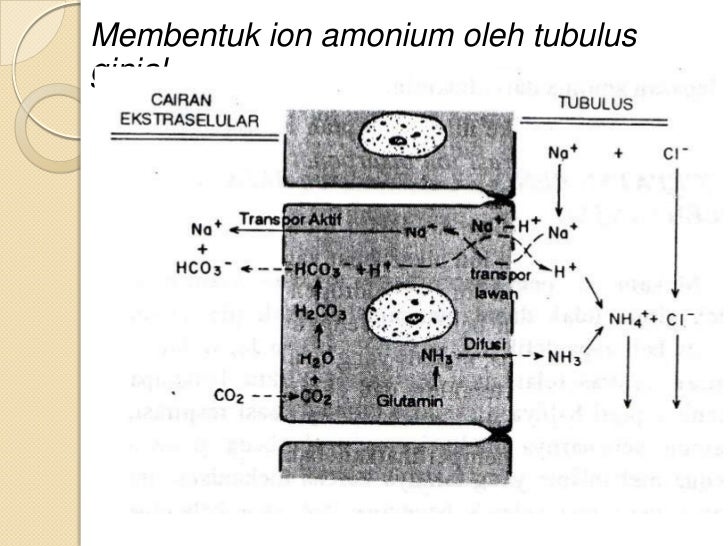 Urolithiasis