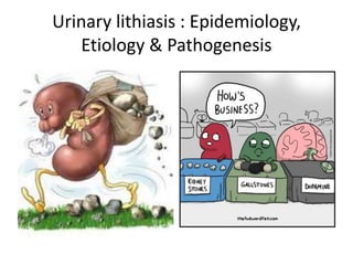 Urinary lithiasis : Epidemiology,
Etiology & Pathogenesis
 