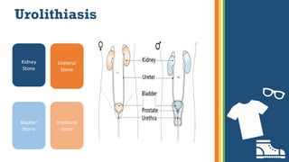 Urolithiasis
Kidney
Stone
Bladder
Stone
Ureteral
Stone
Uretheral
stone
 