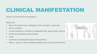 CLINICAL MANIFESTATION
Varied, can be without any symptoms.
Others are:
• Pain in the flank area or radiating. If colic is present : sharp pain
• Pain in urination
• Urinary symptoms: hematuria, suprapubic pain, weak stream, dysuria
• Urine accompanied by stones/sands
• Fever
• Could be accompanied by signs of renal failure
• Others : urgency, various bowel symptoms, pain in the tip of the penis
 