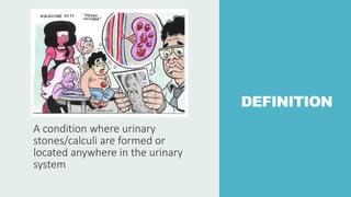 DEFINITION
A condition where urinary
stones/calculi are formed or
located anywhere in the urinary
system
 