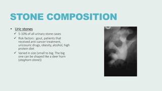 STONE COMPOSITION
• Uric stones
 5-10% of all urinary stone cases
 Risk factors : gout, patients that
received anti-cancer treatment,
uricosuric drugs, obesity, alcohol, high
protein diet
 Varied in size (small to big. The big
one can be shaped like a deer horn
(staghorn stone))
 