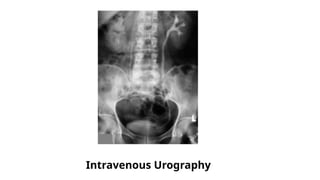 Intravenous Urography
 