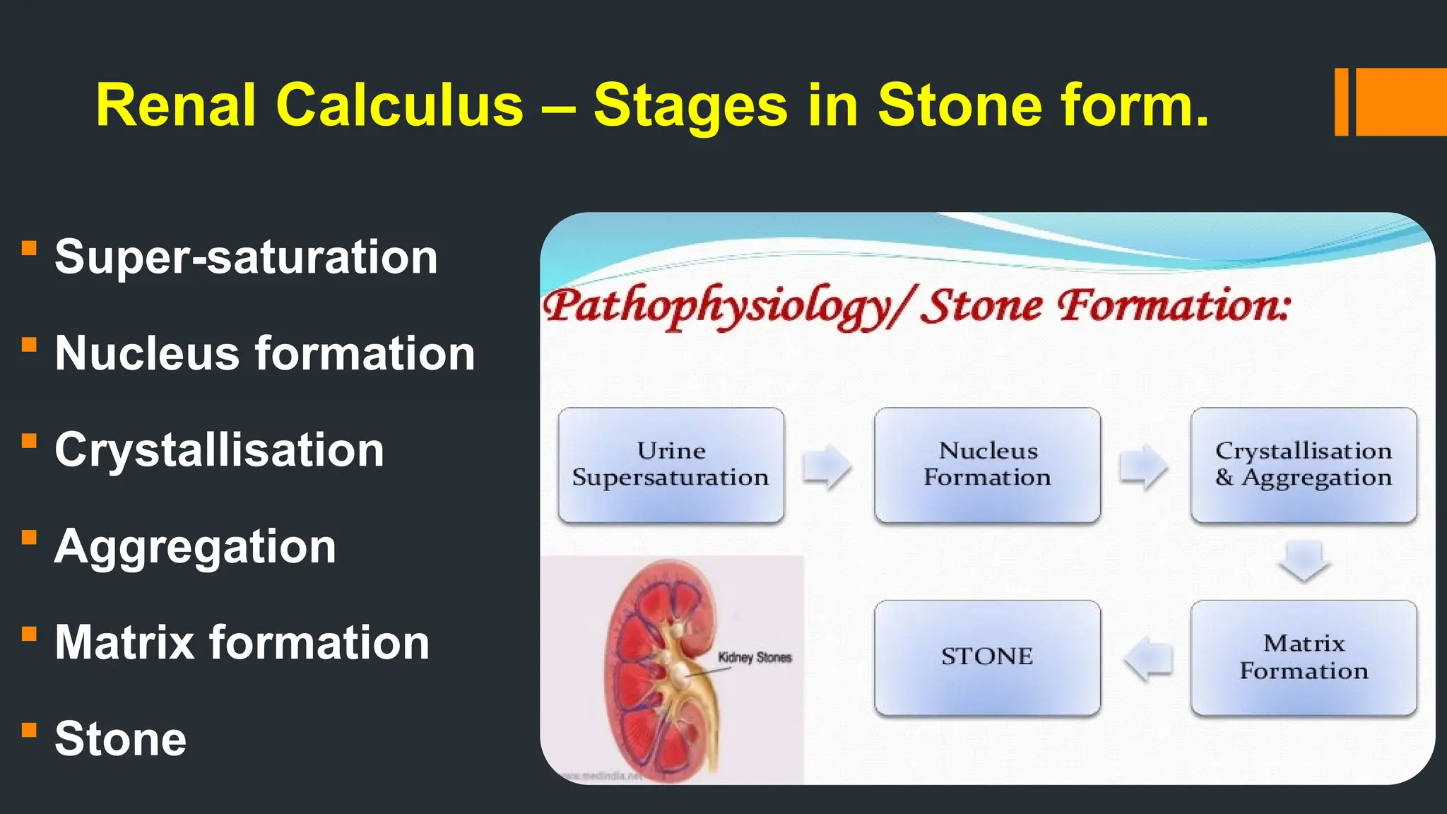 Renal Calculus – Stages in Stone form.
 Super-saturation
 Nucleus formation
 Crystallisation
 Aggregation
 Matrix formation
 Stone
 