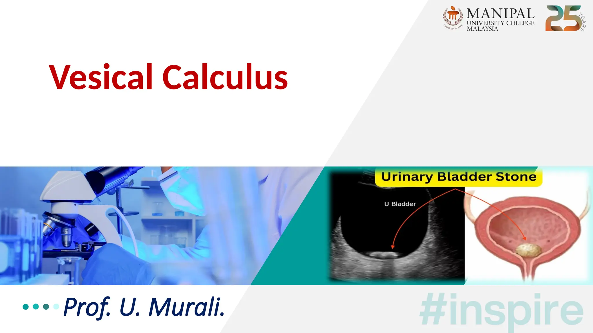 Prof. U. Murali.
Vesical Calculus
 