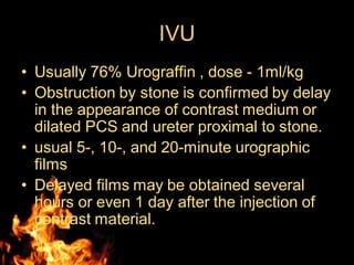 IVU
• Usually 76% Urograffin , dose - 1ml/kg
• Obstruction by stone is confirmed by delay
in the appearance of contrast medium or
dilated PCS and ureter proximal to stone.
• usual 5-, 10-, and 20-minute urographic
films
• Delayed films may be obtained several
hours or even 1 day after the injection of
contrast material.
 