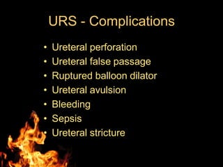 URS - Complications
• Ureteral perforation
• Ureteral false passage
• Ruptured balloon dilator
• Ureteral avulsion
• Bleeding
• Sepsis
• Ureteral stricture
 