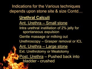 Urethral Calculi
Ant. Urethra – Small stone
Intra urethral instillation of 2% jelly for
spontaneous expulsion
Gentle massage or milking out
Urethroscopy – Grasper removal or ICL
Ant. Urethra – Large stone
Ext. Urethrotomy or Meatotomy
Post. Urethra – Pushed back into
bladder - crushed
Indications for the Various techniques
depends upon stone site & size Contd…
 