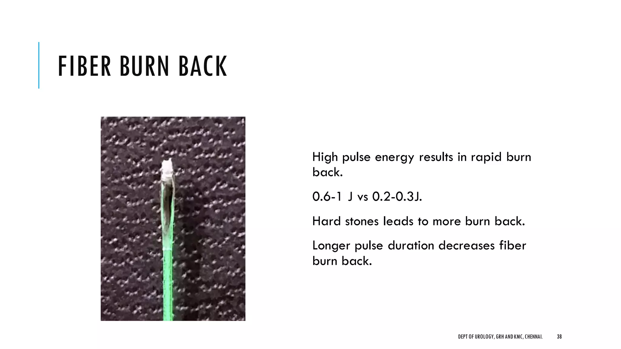 FIBER BURN BACK
High pulse energy results in rapid burn
back.
0.6-1 J vs 0.2-0.3J.
Hard stones leads to more burn back.
Longer pulse duration decreases fiber
burn back.
38
DEPT OF UROLOGY,GRH ANDKMC,CHENNAI.
 